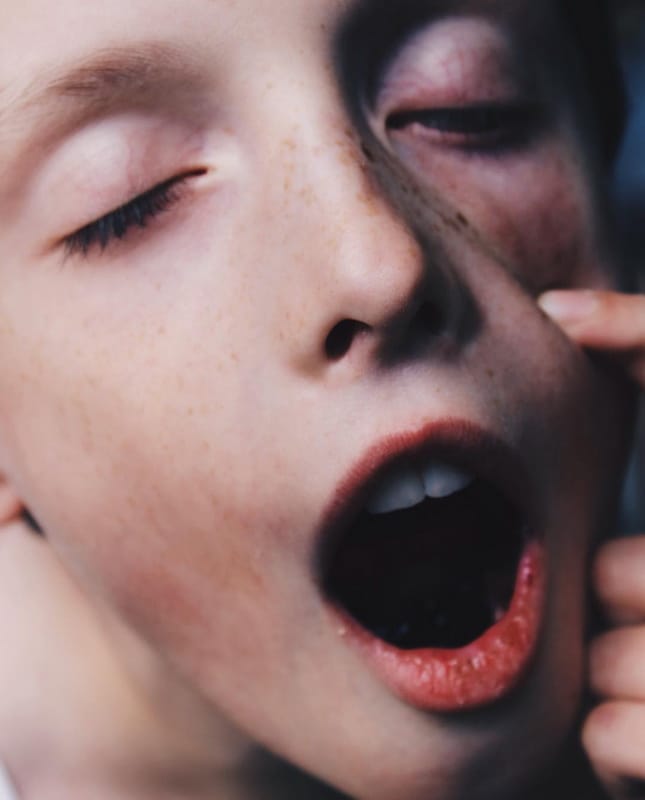 Rotten
